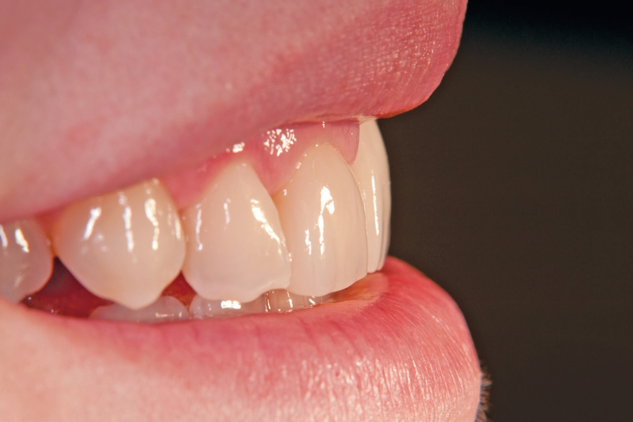 Abb. 19: Lippenbild.