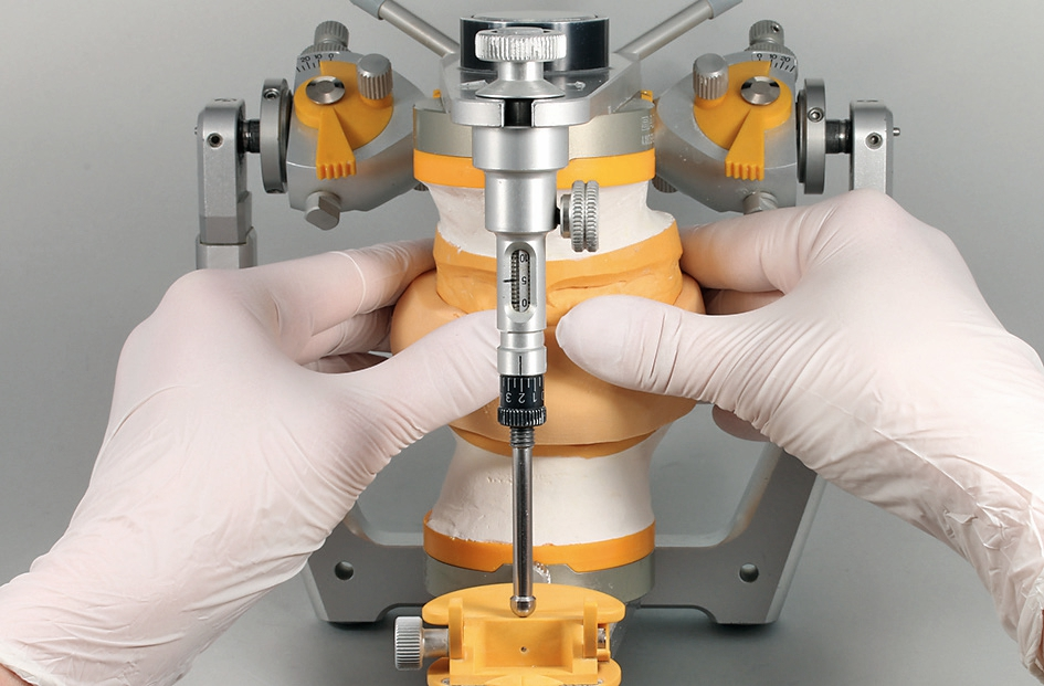 Abb. 32: Silikonummantelung des OK-Modells.