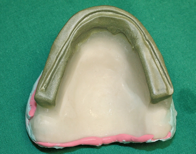 Abb. 14: Das Registrat mit Dachfirstimpressionen.