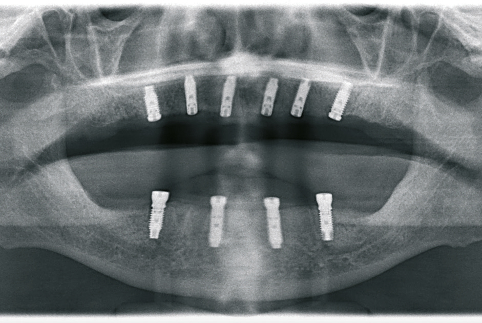 Abb. 17. Röntgenkontrollaufnahme post-OP.