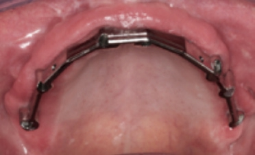 Abb. 19: Der Steg in situ.