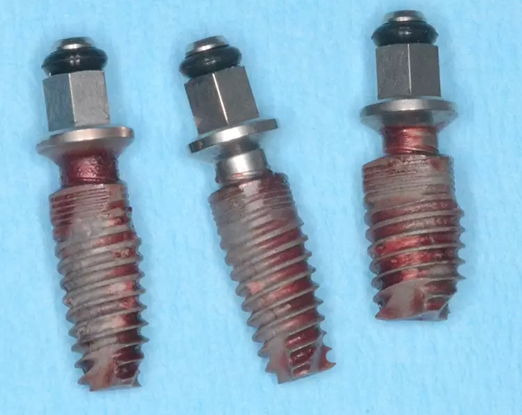 Abb. 19: Explantierte Implantate.