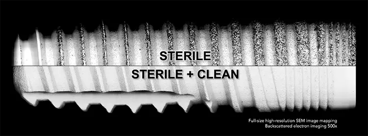 Abb. 1: Ein kombiniertes REM-Bild der Oberfl äche von zwei Implantaten, die jeweils kurz zuvor aus sterilen Verpackungen
entnommen wurden.