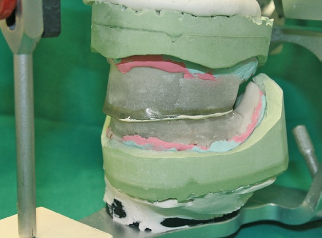 Abb. 15: Das Zentrikregistrat wurde lagegerecht montiert.