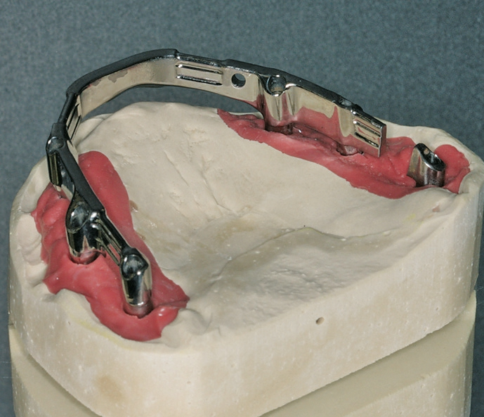 Abb. 18: Der Steg wurde durchtrennt.