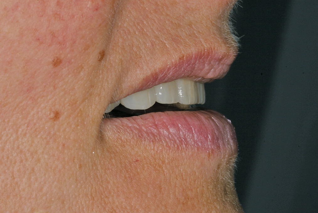 Abb. 20: Ausgeglichenes Lippenbild.