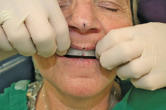 Abb. 16: Bestimmung der Mittellinie anhand mehrerer Kriterien.