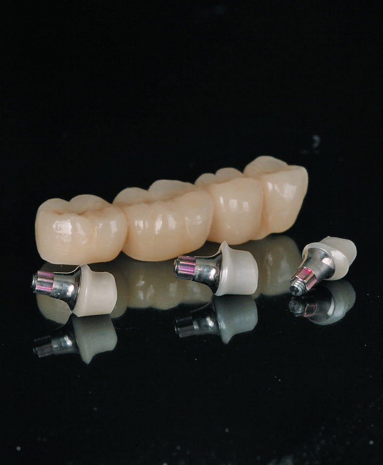 Abb. 24: Das Straumann® Variobase® Sekundärteil bietet die Flexibilität, individuelle prothetische Versorgungen im bevorzugten Workflow herzustellen.