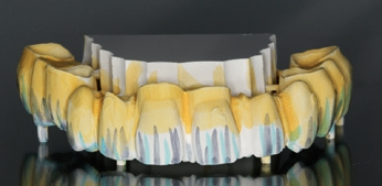 Abb. 22: Zirkongrünling wurde mit Colour Liquid eingefärbt.