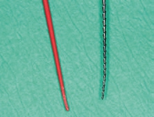 Abb. 13: Aus der Lage und dem Winkel der Markierung im Guttaperchastift lassen sich die Lage und der Winkel der Konfluenz von mb2 und mb1 ermitteln.
