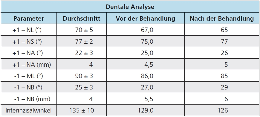 Tab. 3: Dentale Parameter vor und nach der kieferorthopädischen Behandlung.