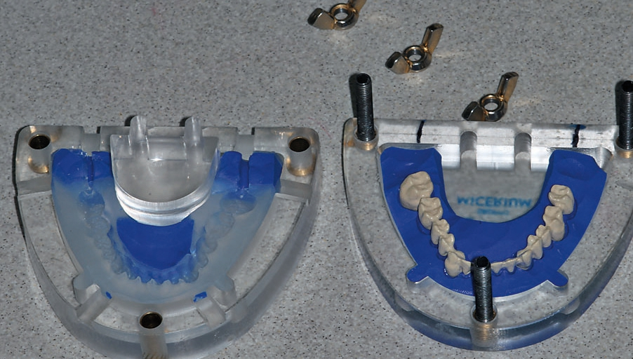 Abb. 35: Fertig opakertes Modell – vorbereitet für die erste Dentinpressung.