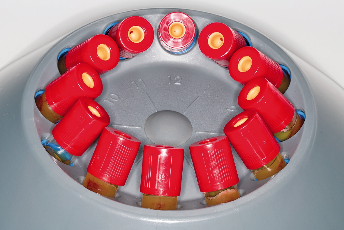 Abb. 27: Zentrifuge, gefüllt mit A-PRF+-Vacuetten.
