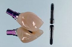 Abb. 28: Langzeitprovisorische Prototypkrone aus Komposit zum Verschrauben für die schrittweise Ausformung des periimplantären Weichgewebes.