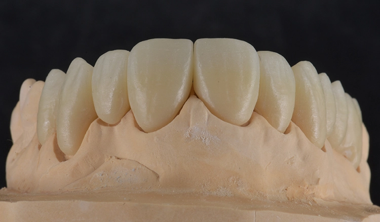 Abb. 2: Vier- und sechsgliedrige Brücken aus KATANA Zirconia YML nach dem Sintern.
