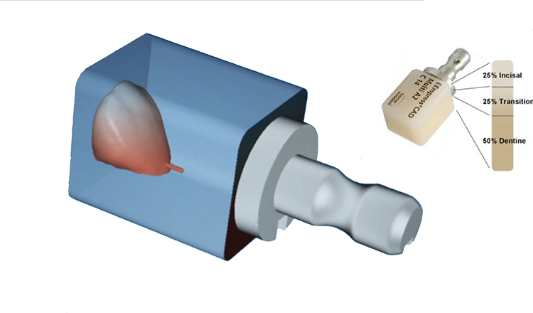 Abb. 5h: Materialwahl – IPS Empress Multi CAD.