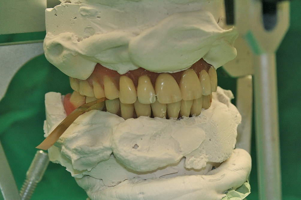 Abb. 28: Die abschließende Remontage und Überprüfung, bevor die Arbeit der Praxis überstellt wird.