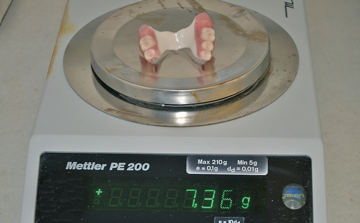 Abb. 34: Das geringe Gewicht des herausnehmbaren Anteils beeindruckte die Patientin.