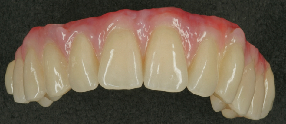 Abb. 35: Fertige Konstruktion von frontal.