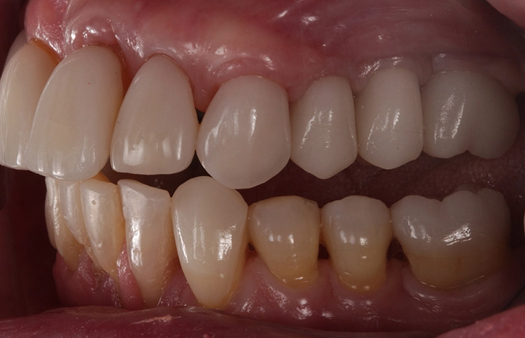 Abb. 39: Lateralansicht links.
