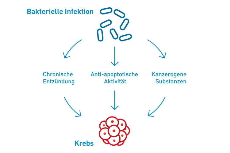 Abb. 3: Der Einfluss oraler Bakterien auf die Pathogenese von Krebs (mod. nach [15]).