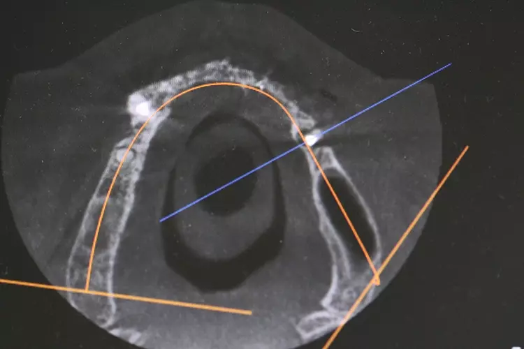 Abb. 3: DVT zur Therapieplanung.