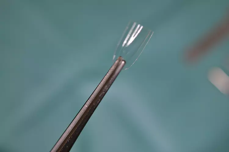 Abb. 5: Alveolenprotektor in der Ansicht von bukkal.