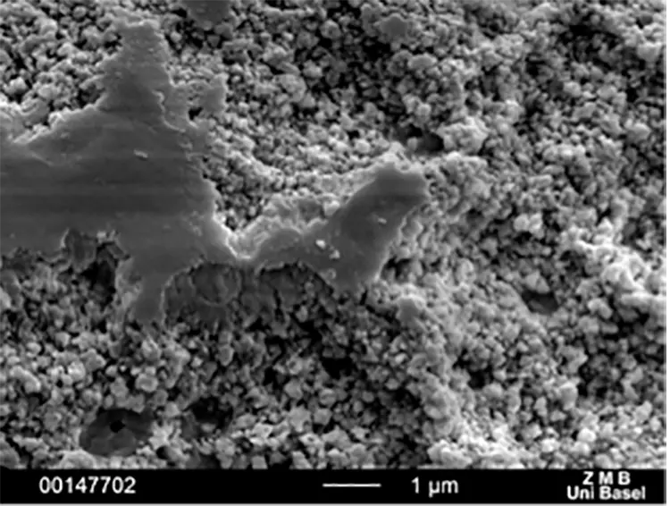 Abb. 6: Intraossäre Oberflächen verschiedener Zirkonoxidimplantate: SEM 10.000x. b: Pure: Oberfläche gestrahlt und geätzt (Straumann, Basel, Schweiz).