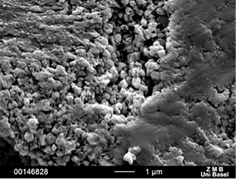 Abb. 6: Intraossäre Oberflächen verschiedener Zirkonoxidimplantate: SEM 10.000x. c: Zeramex: Oberfläche gestrahlt und geätzt (Dentalpoint, Spreitenbach, Schweiz).