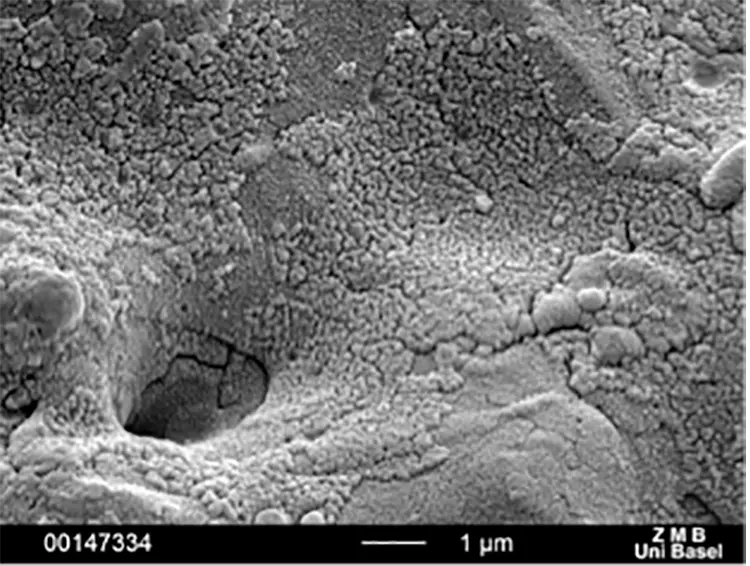 Abb. 6: Intraossäre Oberflächen verschiedener Zirkonoxidimplantate: SEM 10.000x. d: Z5m: Oberfläche gelasert (Z-Systems, Oensingen, Schweiz).