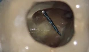 .