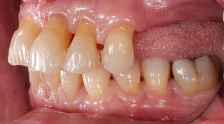 Abb. 8: Lateralansicht links.