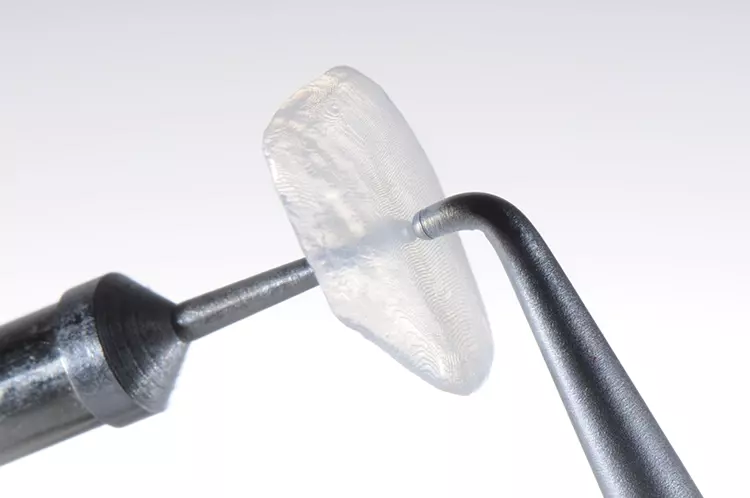 Abb. 12: Die finale Dicke der ultradünnen Veneers betrug nach dem Glasurmassebrand 0,225 mm (0,2 mm Veneer-Schale + 0,025 Glasurmasse).