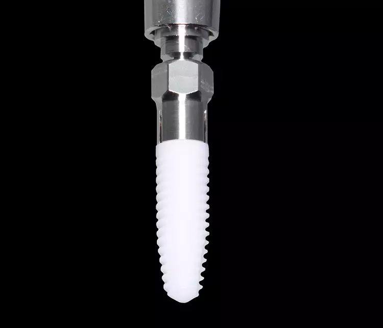 Abb.10: Neodent ZI: Der obere
Implantatanteil ist paralellwandig,
der untere apikale Teil konisch.