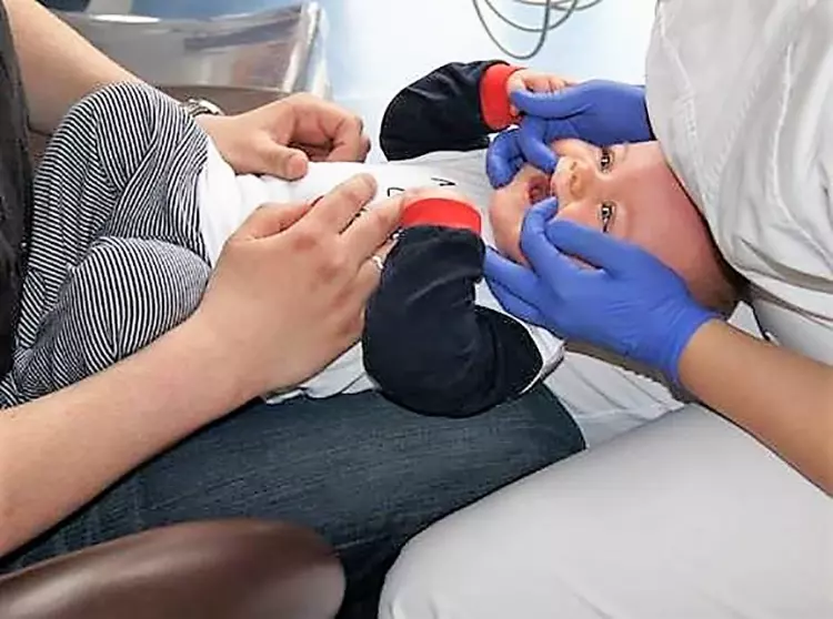 Abb. 11: Für die zahnärztliche Frühuntersuchung kann das kleine Kind in den
Schoß des Zahnarztes gekippt werden. Dabei kann das Kleinkind die Erziehungsperson
gut sehen. Diese liegende Position eignet sich sehr gut für die Inspektion.