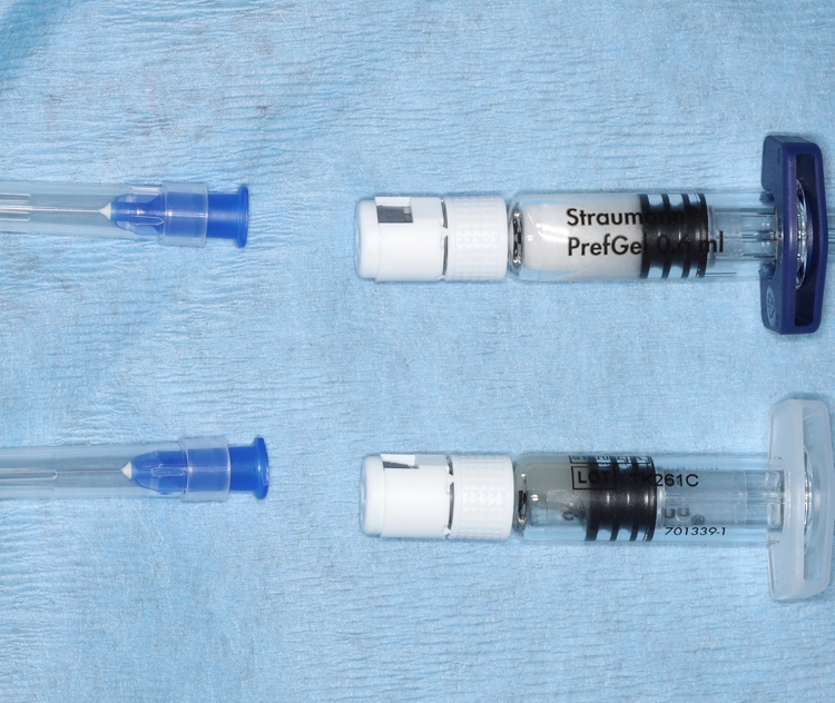 Abb. 14: Emdogain® FL-Applikator mit speziellem Aufsatz erleichtert das Einbringen des Gels in die tiefe Parodontaltasche.