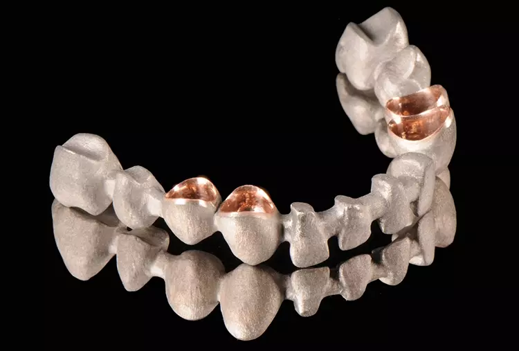 Abb. 13: Demonstration eines Metallgerüstes für eine Teleskopversorgung im Unterkiefer aus 2 verschiedenen Metallen, zusammen hergestellt in einem Bauprozess
mittels Metall-Multimaterial-3D-Druck.