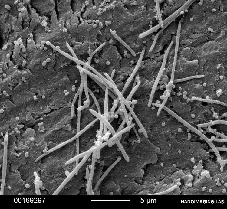 Abb. 18: Bakterienbesiedlung auf verschiedenen Befestigungsmaterialien. a: RelyX Ultimate (3M).
