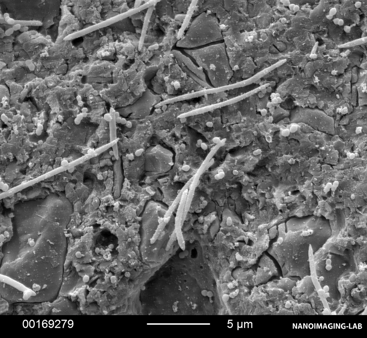 Abb. 18: Bakterienbesiedlung auf verschiedenen Befestigungsmaterialien. b: RelyX Unicem (3M).