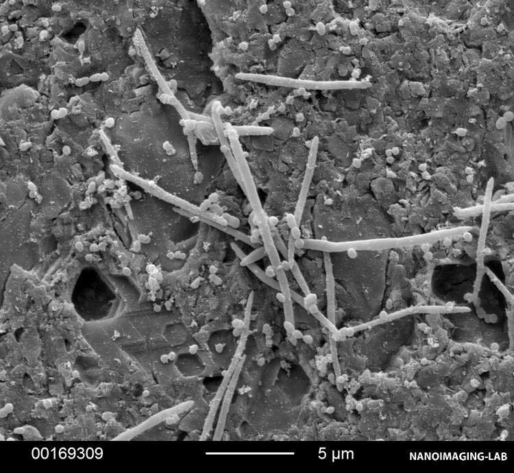 Abb. 18: Bakterienbesiedlung auf verschiedenen Befestigungsmaterialien. c: Vita Adiva F-Cem (Vita) [1].