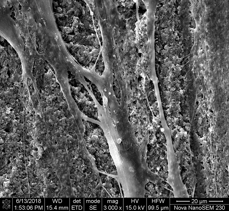 Abb. 19: Anlagerung von Fibroblasten auf unterschiedlich rauen Oberflächen von Multilink Automix. b: Oberflächenbearbeitung mit 400er Schleifpapier (grob), deutlich zu erkennen ist die Orientierung der Fibroblasten entlang der Schleifrillen.