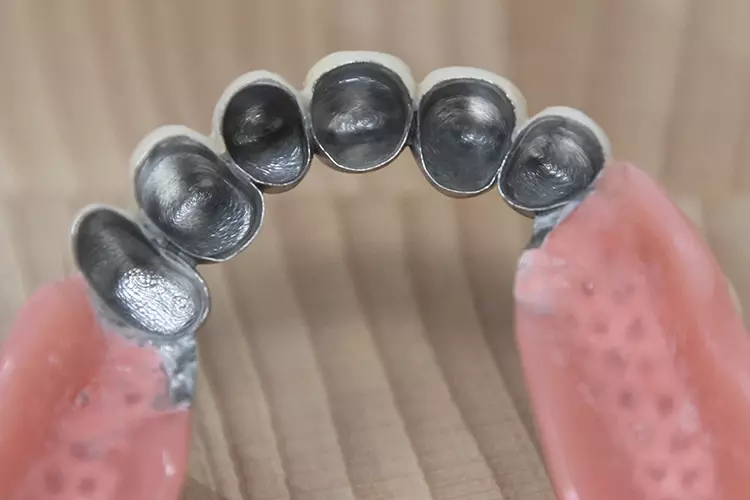 Abb. 1: Laser-gemeltete Arbeiten bedürfen einer stärkeren Nachbearbeitung, was
zu schwankenden Ergebnissen führen kann. Hier z.B. ließ sich die Innenflächen der
Sekundärteleskope nicht zu 100 Prozent auf Glanz bringen. Hinzu kam ein unzureichender
Randschluss und eine ungleichmäßige parallele Fräsung der Primärteleskope.