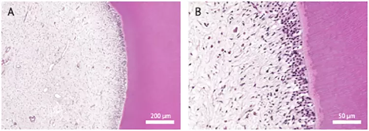 Abb. 1: Histologische Aufbereitung und Hämatoxylin-Eosin-Färbung des Pulpa-Dentin-Komplexes. A) Pulpa (links) und Dentin (rechts) bilden einen eng miteinander verbundenen Gewebekomplex. B) Zu erkennen sind von links nach rechts: Das lockere Bindegewebe der Pulpa mit Fibroblasten, Nerven und Blutgefäßen; säulenförmige, palisadenartig angeordnete Odontoblasten deren Fortsätze in das Dentin hineinragen; unmineralisiertes Prädentin (hellrosa) und mit Tubuli durchzogenes Dentin (dunkler gefärbt).