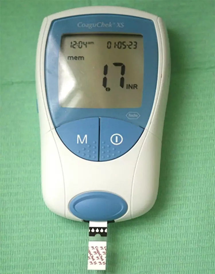 Abb. 1: Mobiles Messgerät zur Selbstbestimmung des INR-Wertes (Messwert für
die Blutgerinnung bei der Behandlung mit VKA).