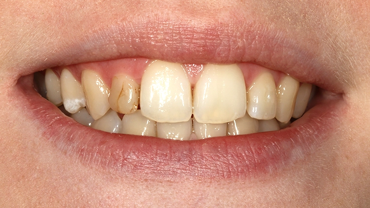 Abb. 1: Lippenbild des Eingangsbefundes.