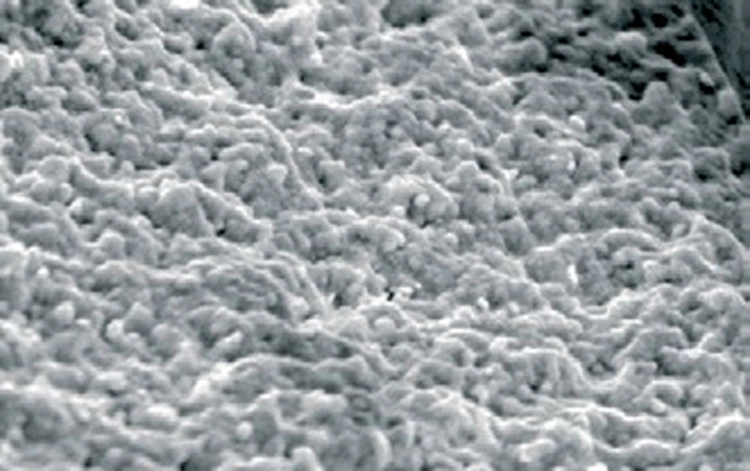 Abb. 1: Die Oberfläche des rauen Patent™-Implantats
von Zirkon-Medical (Vertrieb: Champions-Implants
GmbH).