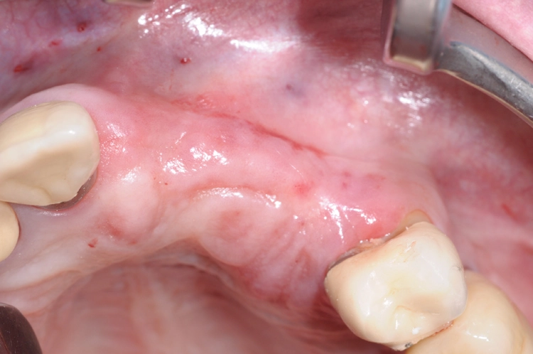 Abb. 1: Okklusale Ansicht der Ausgangssituation.