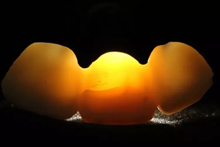 Abb. 1: Mikroriss in durchleuchteter vollkeramischer Brücke.