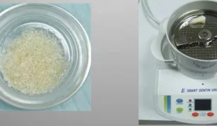 Abb. 1: Die delegierbare Aufbereitung von natürlichen extrahierten Zähnen zur Augmentation mit dem Smart Grinder.