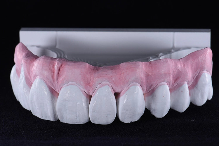 Esthetic Colorant wird auf Gingiva-Anteile sowie Zähne appliziert,